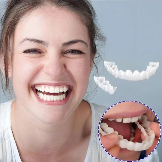 Removable Upper and Lower Cosmetic Smile Cover System