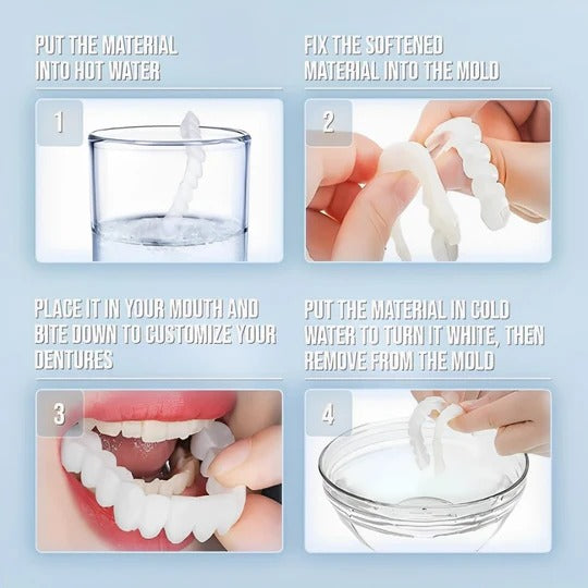 Removable Upper and Lower Cosmetic Smile Cover System